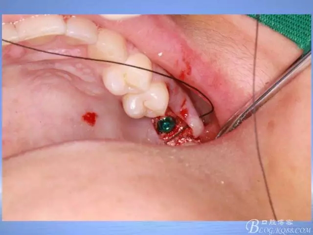 640.webp (28).jpg 640.webp (28).jpg