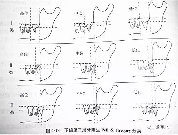 640.webp.jpg 640.webp.jpg