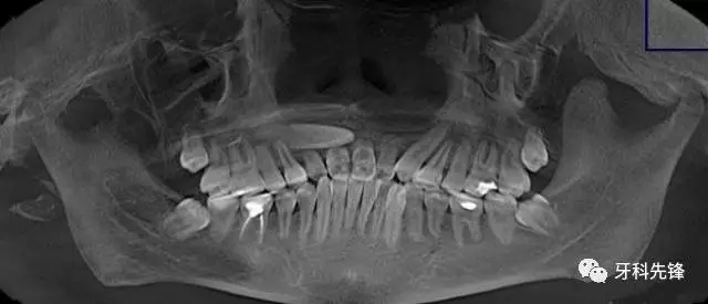 640.webp (1).jpg 640.webp (1).jpg