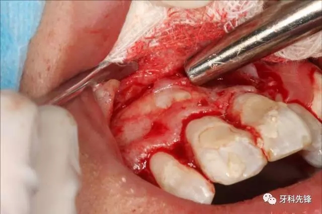 640.webp (5).jpg 640.webp (5).jpg