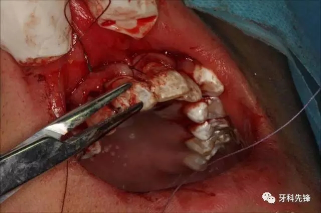 640.webp (13).jpg 640.webp (13).jpg