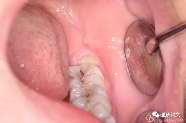 640.webp (1).jpg 640.webp (1).jpg