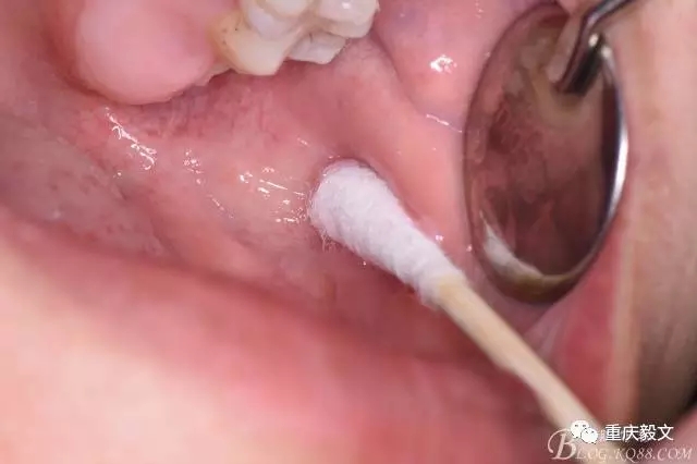 640.webp (2).jpg 640.webp (2).jpg