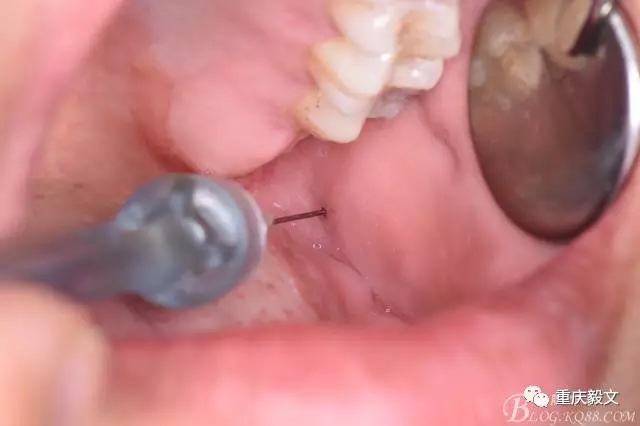 640.webp (3).jpg 640.webp (3).jpg