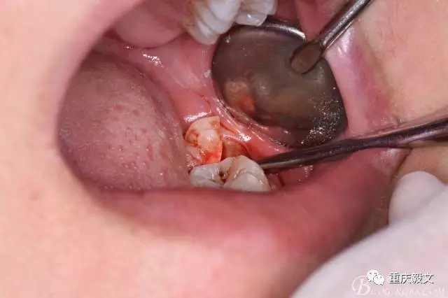 640.webp (10).jpg 640.webp (10).jpg