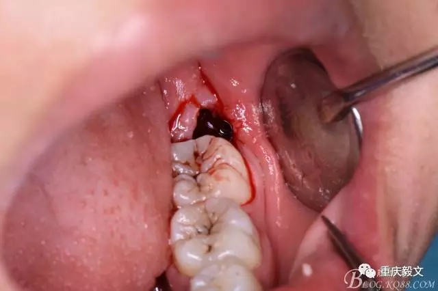 640.webp (17).jpg 640.webp (17).jpg