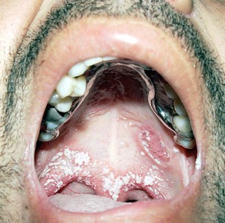 1372615541.jpg 1372615541.jpg