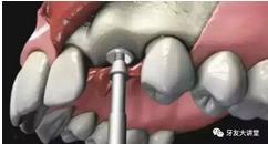 360截圖20170107143412357.jpg 360截圖20170107143412357.jpg