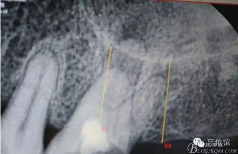 360截圖20170107164519341.jpg 360截圖20170107164519341.jpg