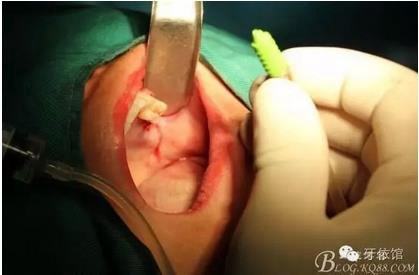 360截圖20170107165031859.jpg 360截圖20170107165031859.jpg