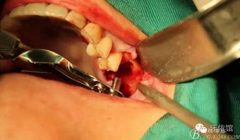 360截圖20170107165400772.jpg 360截圖20170107165400772.jpg