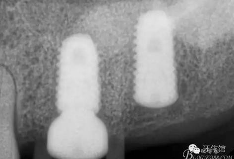 360截圖20170107165515851.jpg 360截圖20170107165515851.jpg