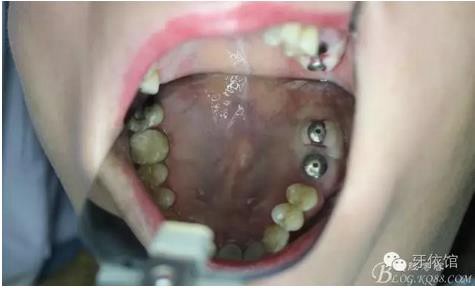 360截圖20170107165532860.jpg 360截圖20170107165532860.jpg