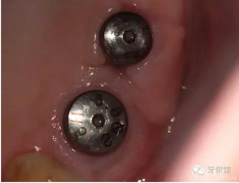 360截圖20170107165550700.jpg 360截圖20170107165550700.jpg