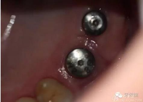 360截圖20170107165623412.jpg 360截圖20170107165623412.jpg