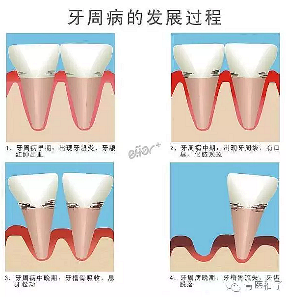 )6{[V%Q3M_~A25MA72_VN}Y.png )6{[V%Q3M_~A25MA72_VN}Y.png