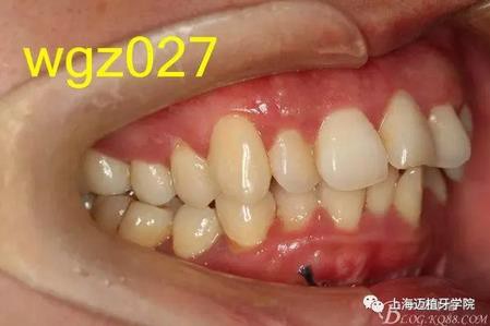 360截圖20170119161108820.jpg 360截圖20170119161108820.jpg