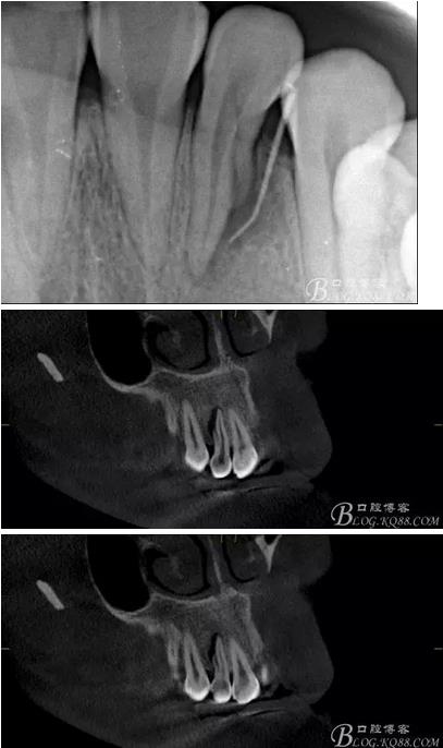 360截圖20170119164942599.jpg 360截圖20170119164942599.jpg