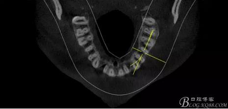 360截圖20170119165037167.jpg 360截圖20170119165037167.jpg