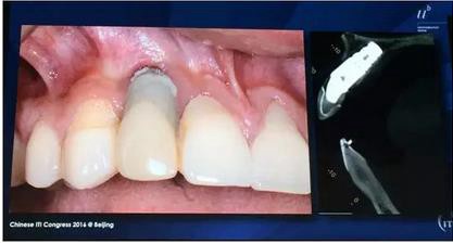 360截圖20170119173513265.jpg 360截圖20170119173513265.jpg