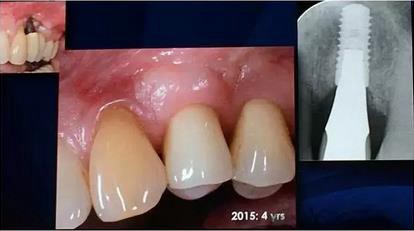 360截圖20170119173648688.jpg 360截圖20170119173648688.jpg