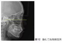 360截圖20170119193927900.jpg 360截圖20170119193927900.jpg