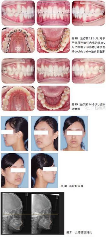 360截圖20170119194007237.jpg 360截圖20170119194007237.jpg