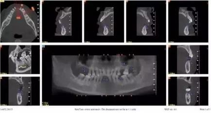 360截圖20170120114738053.jpg 360截圖20170120114738053.jpg