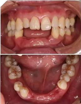 360截圖20170120114752103.jpg 360截圖20170120114752103.jpg