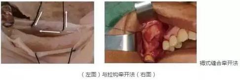 360截圖20170120140747822.jpg 360截圖20170120140747822.jpg