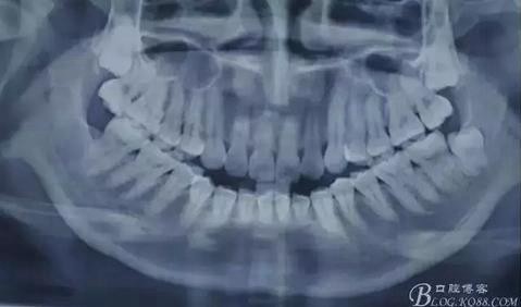 360截圖20170120141404710.jpg 360截圖20170120141404710.jpg