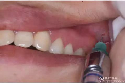 360截圖20170120141411511.jpg 360截圖20170120141411511.jpg