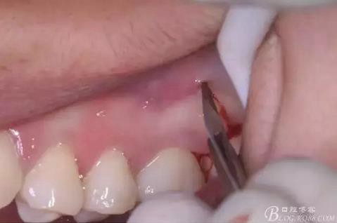 360截圖20170120141428871.jpg 360截圖20170120141428871.jpg