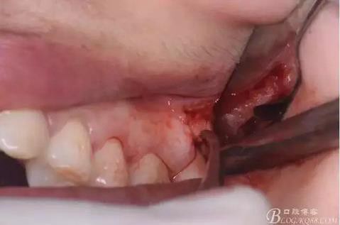 360截圖20170120141442636.jpg 360截圖20170120141442636.jpg