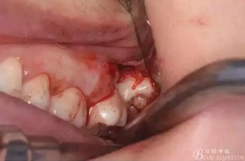 360截圖20170120141508600.jpg 360截圖20170120141508600.jpg