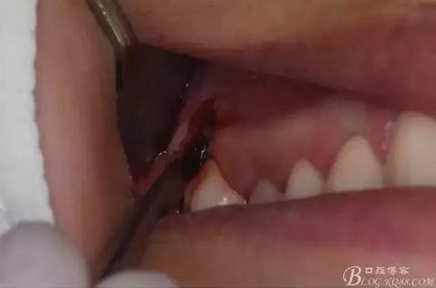 360截圖20170120141545205.jpg 360截圖20170120141545205.jpg