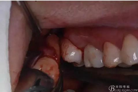 360截圖20170120141645478.jpg 360截圖20170120141645478.jpg