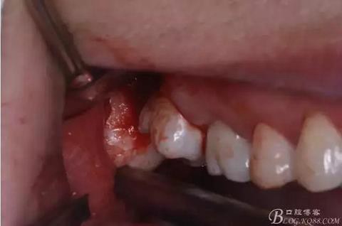 360截圖20170120141635670.jpg 360截圖20170120141635670.jpg