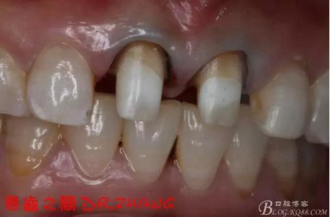 360截圖20170120151138386.jpg 360截圖20170120151138386.jpg