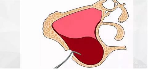 360截圖20170120155529779.jpg 360截圖20170120155529779.jpg