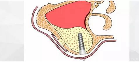 360截圖20170120155546307.jpg 360截圖20170120155546307.jpg