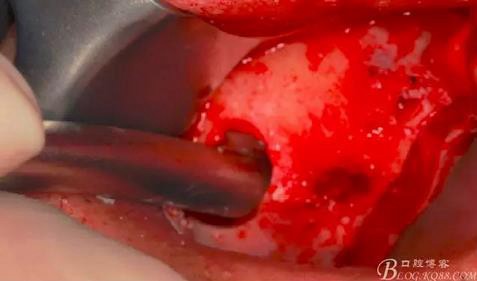 360截圖20170120155828883.jpg 360截圖20170120155828883.jpg