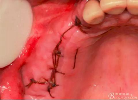 360截圖20170120155901388.jpg 360截圖20170120155901388.jpg