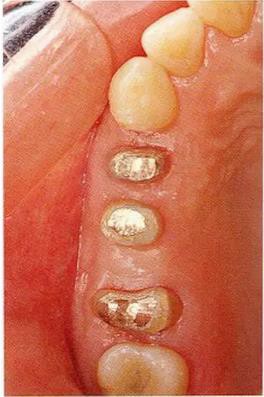 360截圖20170120170954282.jpg 360截圖20170120170954282.jpg