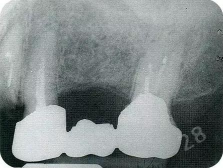 360截圖20170120171111479.jpg 360截圖20170120171111479.jpg