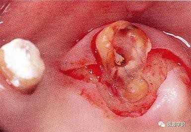 360截圖20170120171131583.jpg 360截圖20170120171131583.jpg