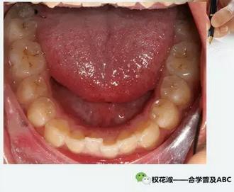 360截圖20170121090325322.jpg 360截圖20170121090325322.jpg