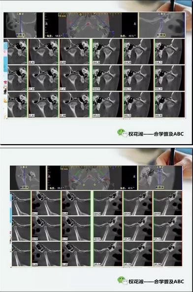 360截圖20170121090337012.jpg 360截圖20170121090337012.jpg
