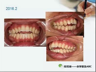 360截圖20170121090347675.jpg 360截圖20170121090347675.jpg