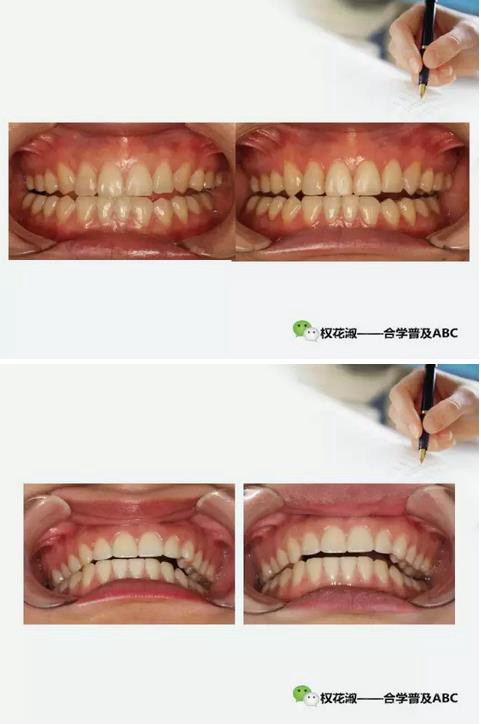 360截圖20170121124122581.jpg 360截圖20170121124122581.jpg